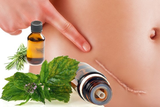 Los 10 aceites esenciales para masajes anti cicatrices.
