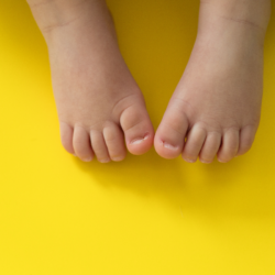 Piedini di bambino su sfondo giallo: pelle sensibile che richiede cure specifiche per prevenire irritazioni e disturbi cutanei.