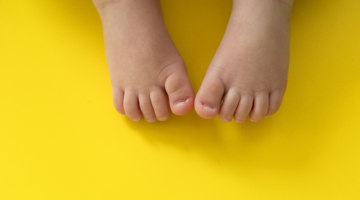 Patologías cutáneas pediátricas comunes en lactantes