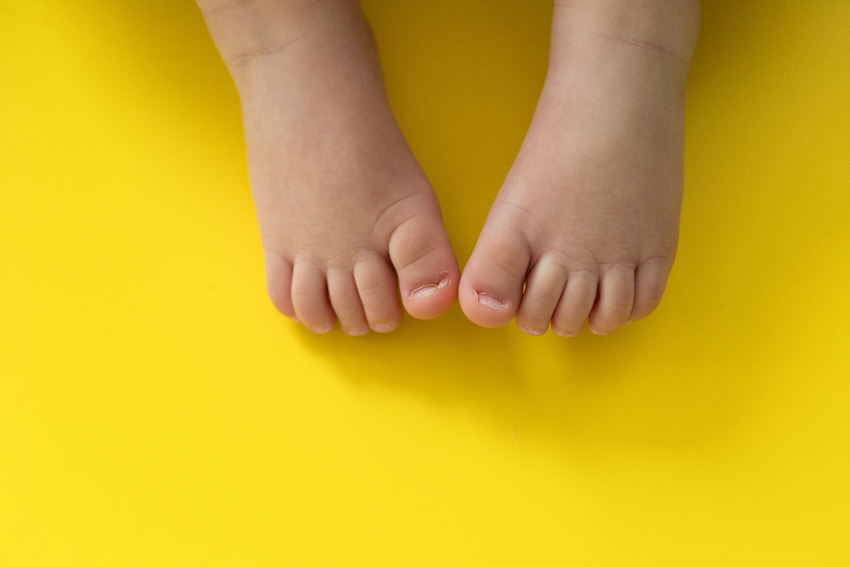 Small infant feet on yellow background: sensitive skin requiring specific care to prevent irritation and skin disorders.