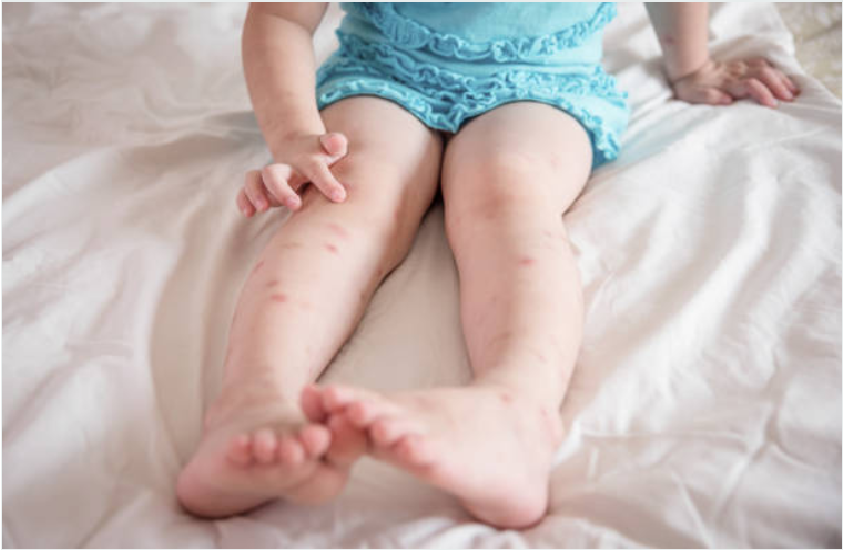 protéger naturellement bébé contre les moustiques