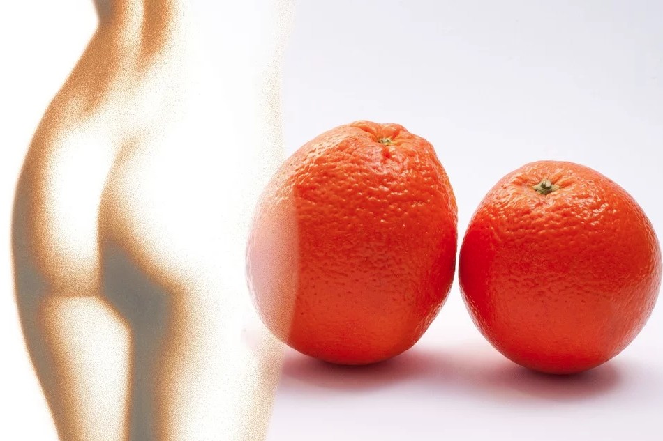 Quel traitement naturel contre la cellulite choisir