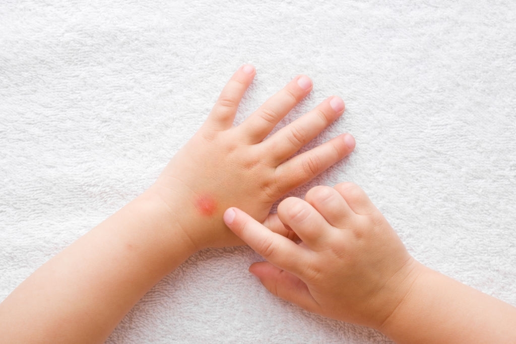 Hoe baby op natuurlijke wijze beschermen tegen muggen?