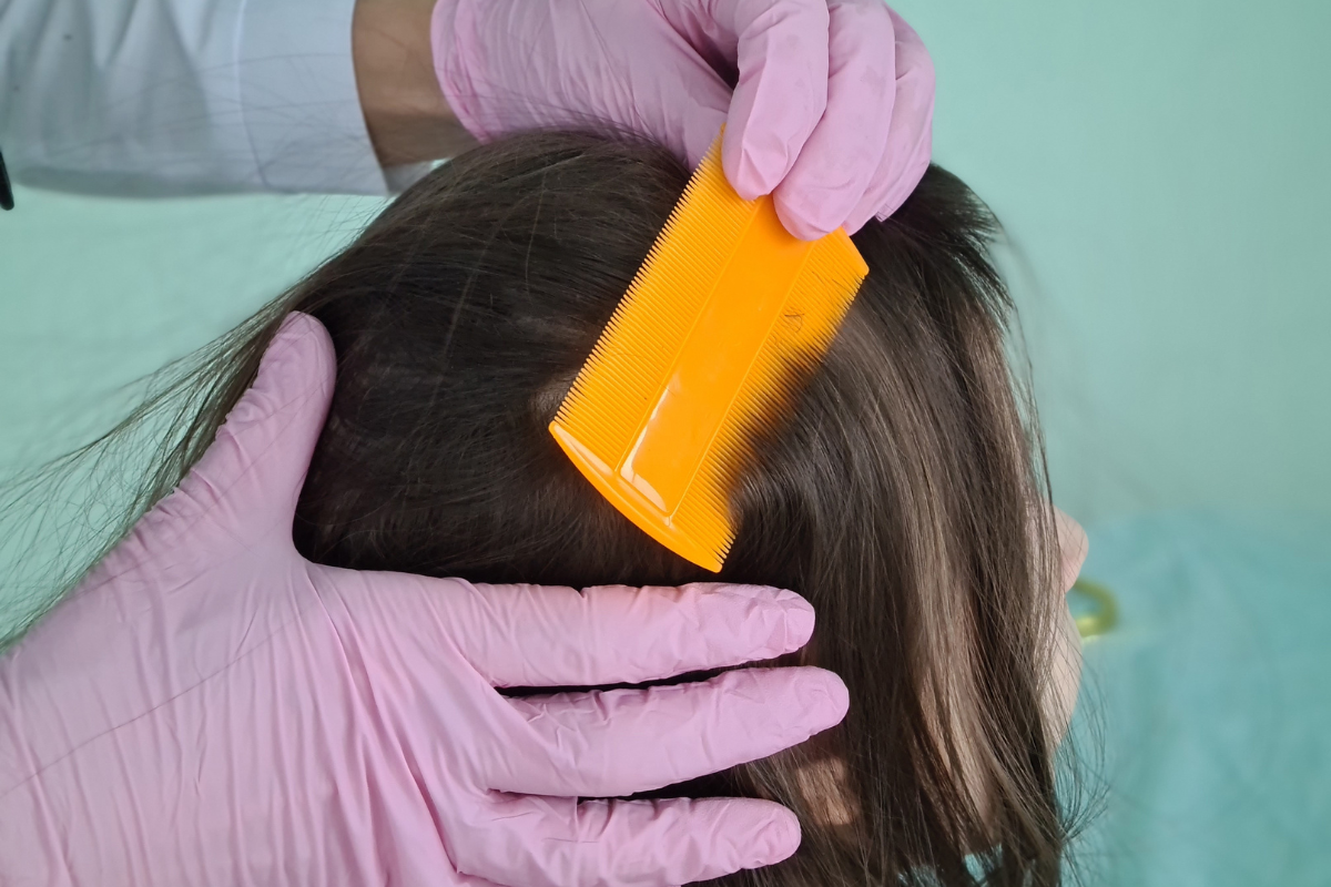 Peigne à poux glissant sur les cheveux d’un enfant pour détecter et éliminer les lentes, méthode naturelle sans insecticide.