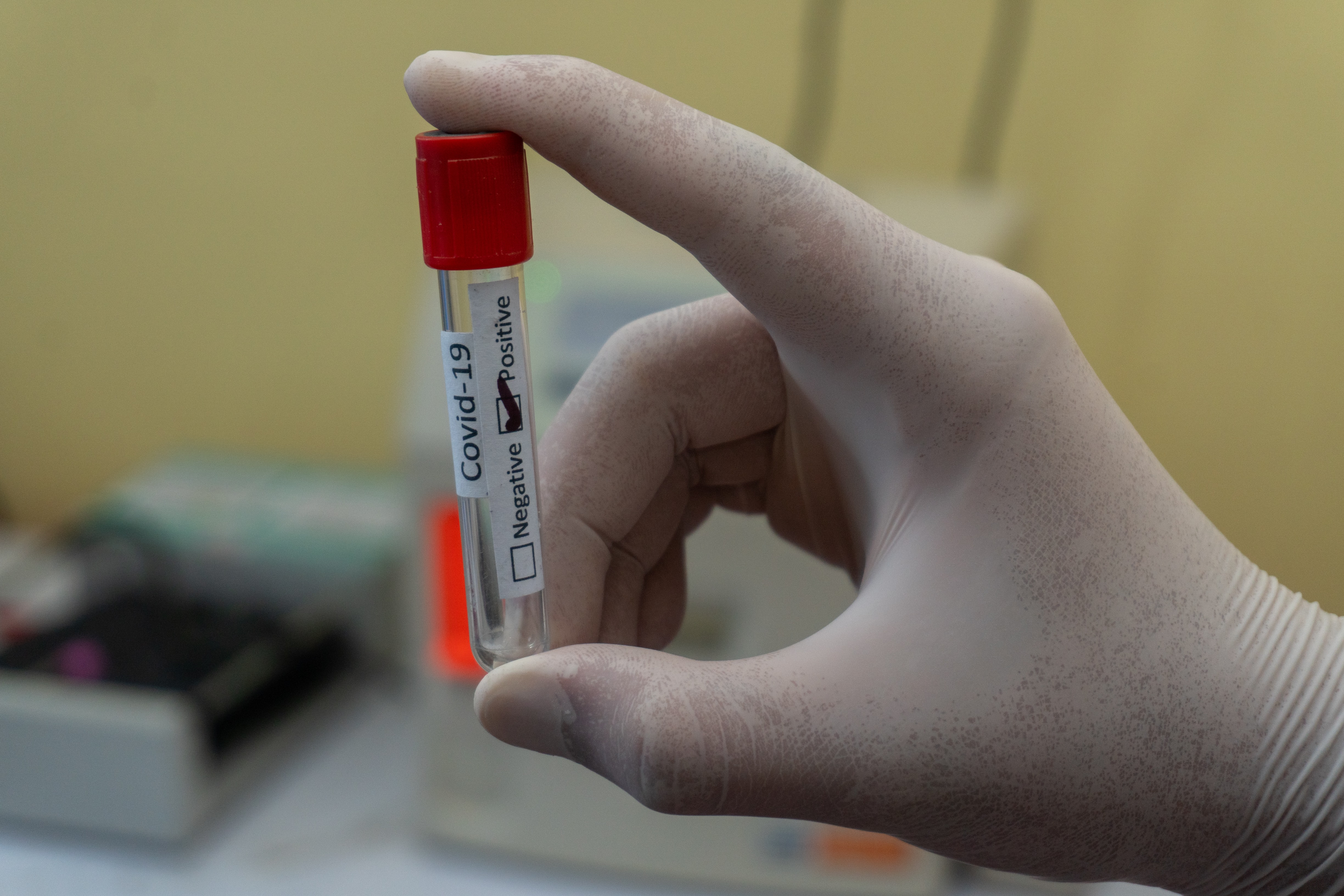 récipient test pour la COVID-19