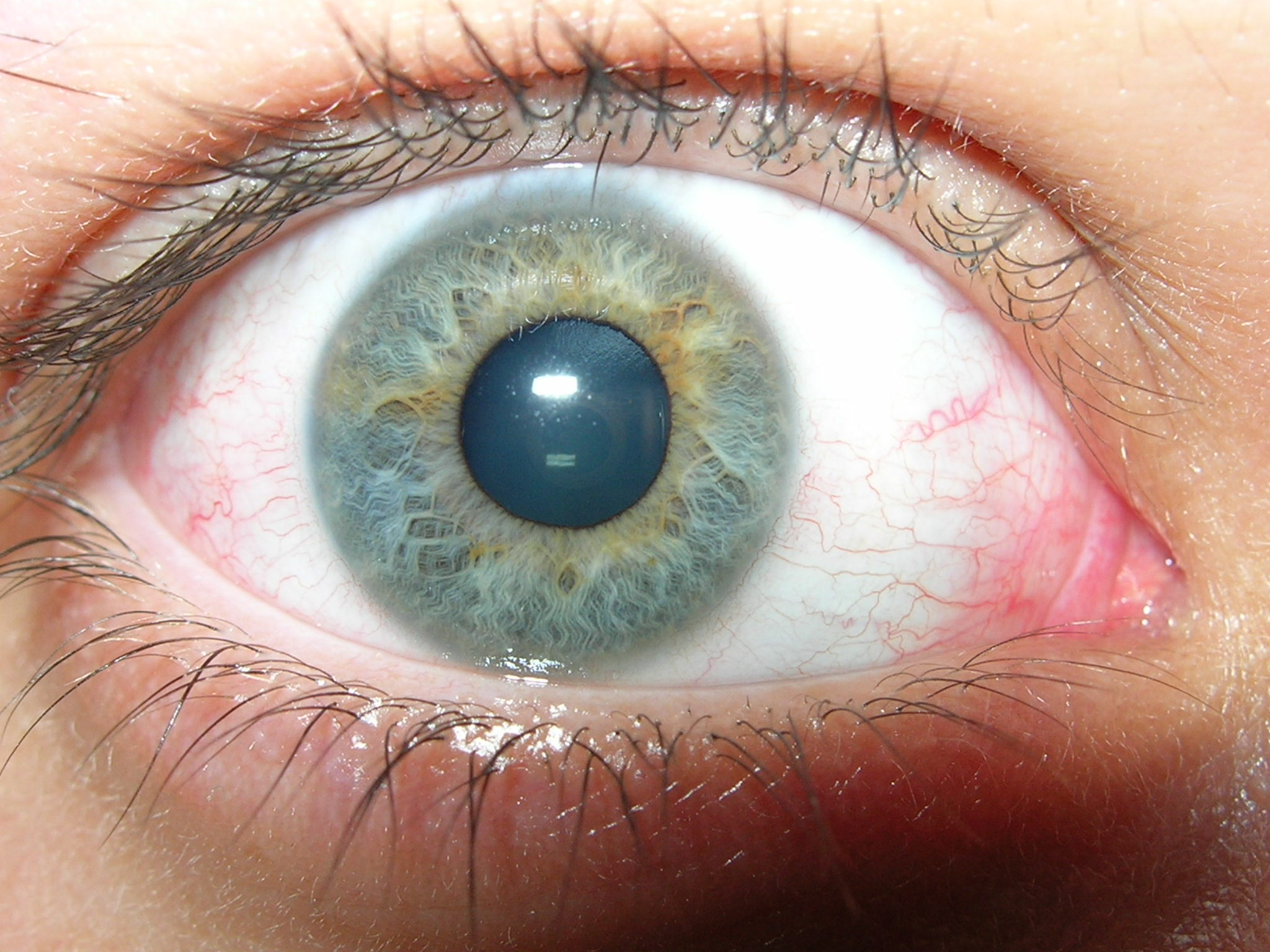 Gouttes oculaires pour le traitement des yeux secs ou fatigués