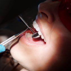 Trate a doença periodontal naturalmente com fitoterapia
