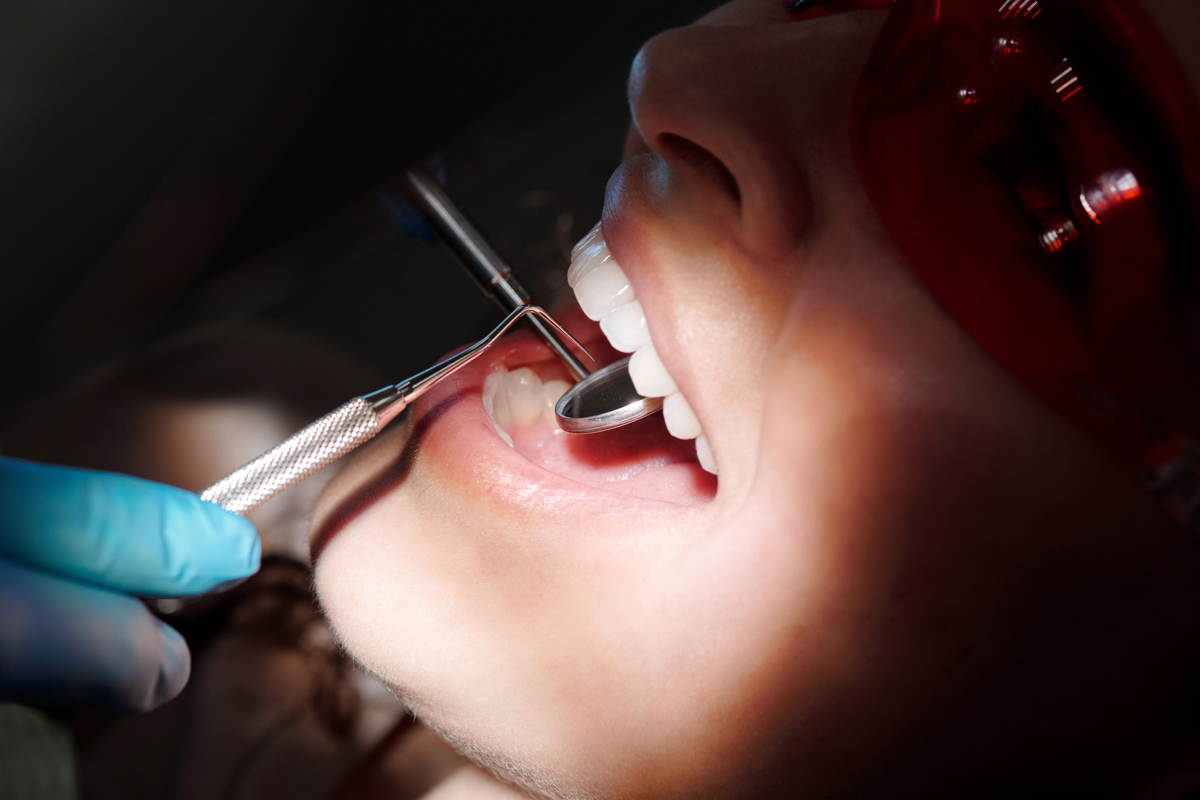 Trate a doença periodontal naturalmente com fitoterapia