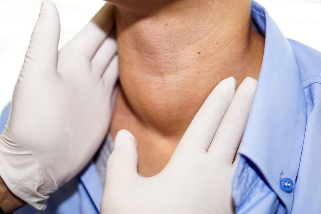 Graves' disease, autoimmune thyroiditis caused by various factors