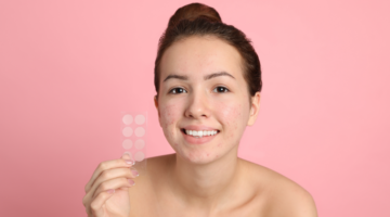 Natural treatments to help acne sufferers