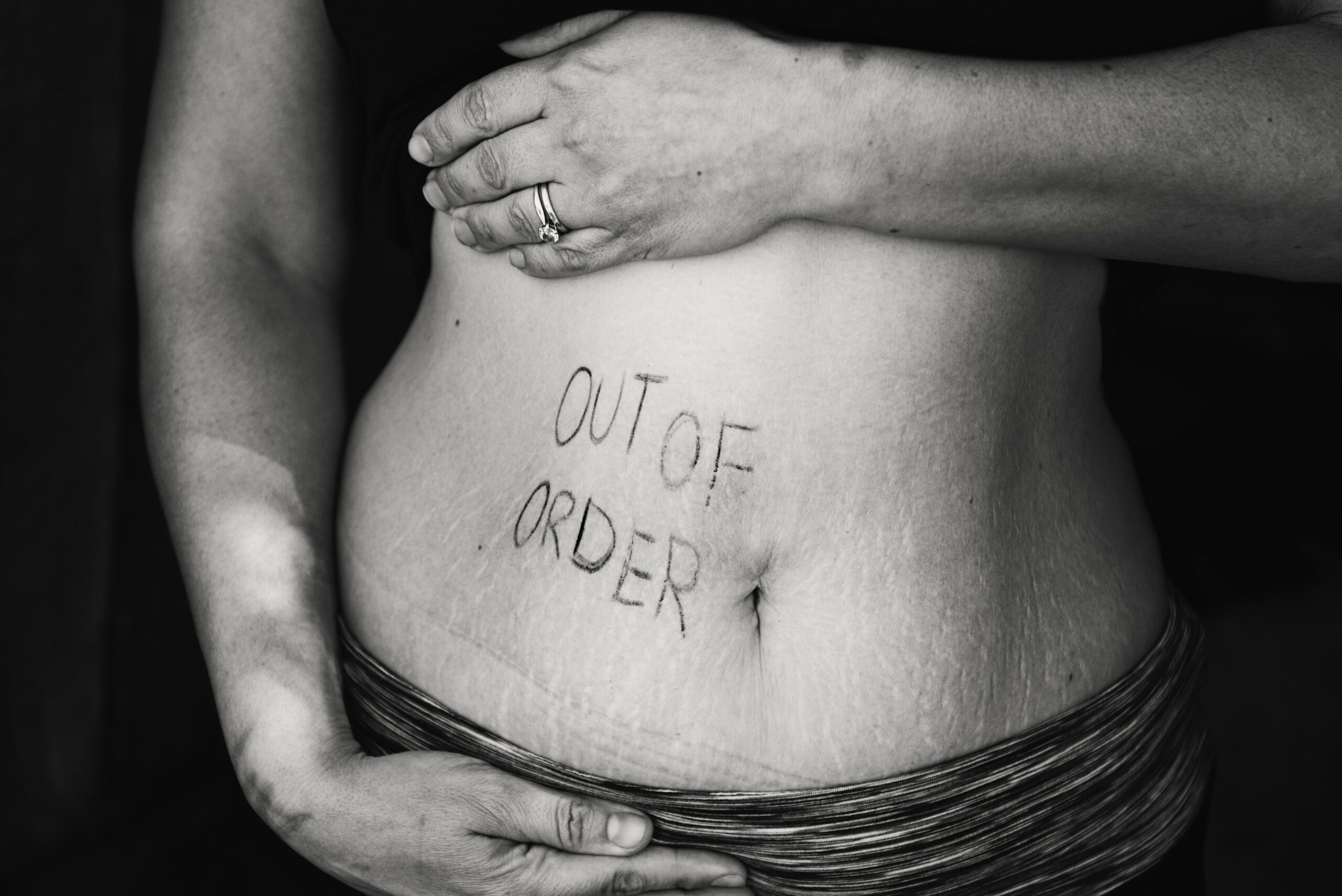 Photo représentant un ventre avec un message dessus ou il est écrit " out of order"