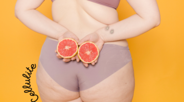 How to lose weight and fight against cellulite with essential oils?