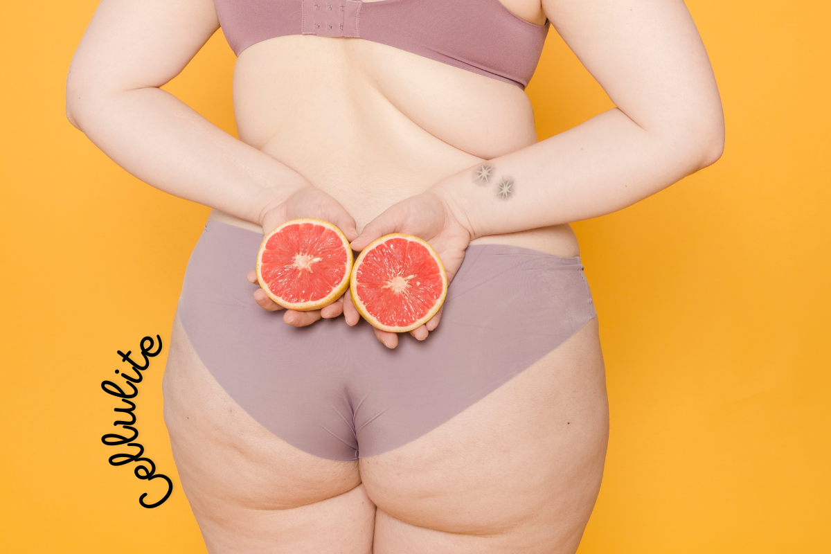 Femme en sous-vêtements tenant des moitiés de pamplemousse contre ses fesses, illustrant la cellulite et les remèdes naturels.