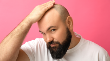 Hoe kaalheid te vertragen