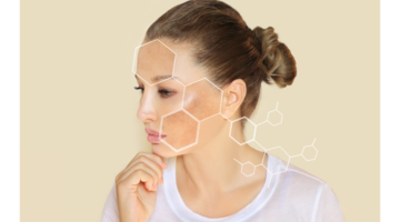 What are the benefits of tranexamic acid for the skin?