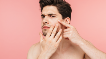 Curaspot om af te spoelen, mijn anti-acne bondgenoot