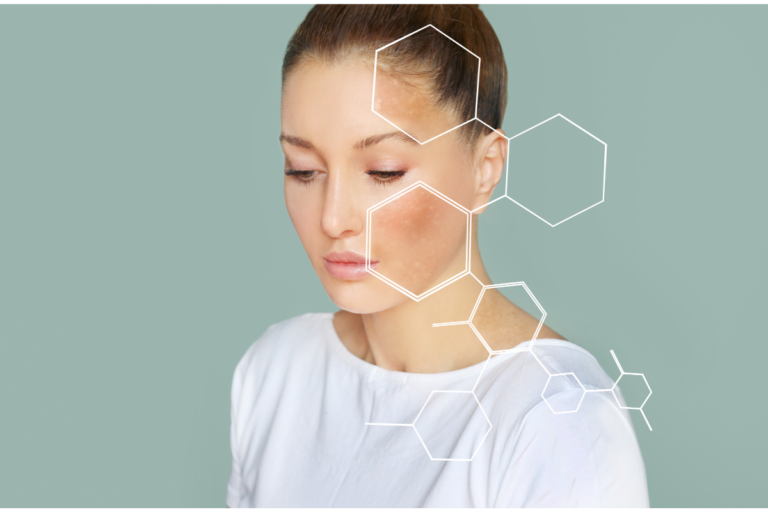 Masque de grossesse : comment éviter cette pigmentation