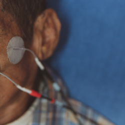 l'image représente un homme atteint de paralysie faciale avec un appareil d'électrostimulation de style TENS