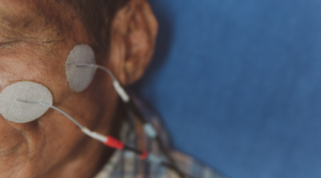 Tutto quello che c'è da sapere sulla paralisi di Bell