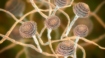 Die aufkommende Bedrohung durch Aspergillosen