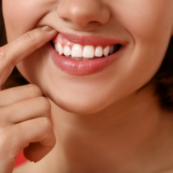 Sourire d'une femme montrant ses gencives en bonne santé, elle ne souffre pas de gingivite.