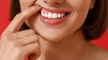 Gingivitis: Welches Probiotikum für gesundes Zahnfleisch wählen?