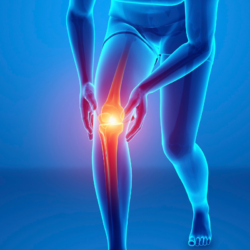 Illustration des douleurs articulaires mettant en évidence les zones inflammatoires du corps, représentant les principaux facteurs de risque de l’arthrose.