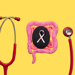 Illustration d’un intestin en pâte à modeler avec un ruban rose symbolisant le cancer du sein, entouré d’un stéthoscope rouge, sur un fond jaune.