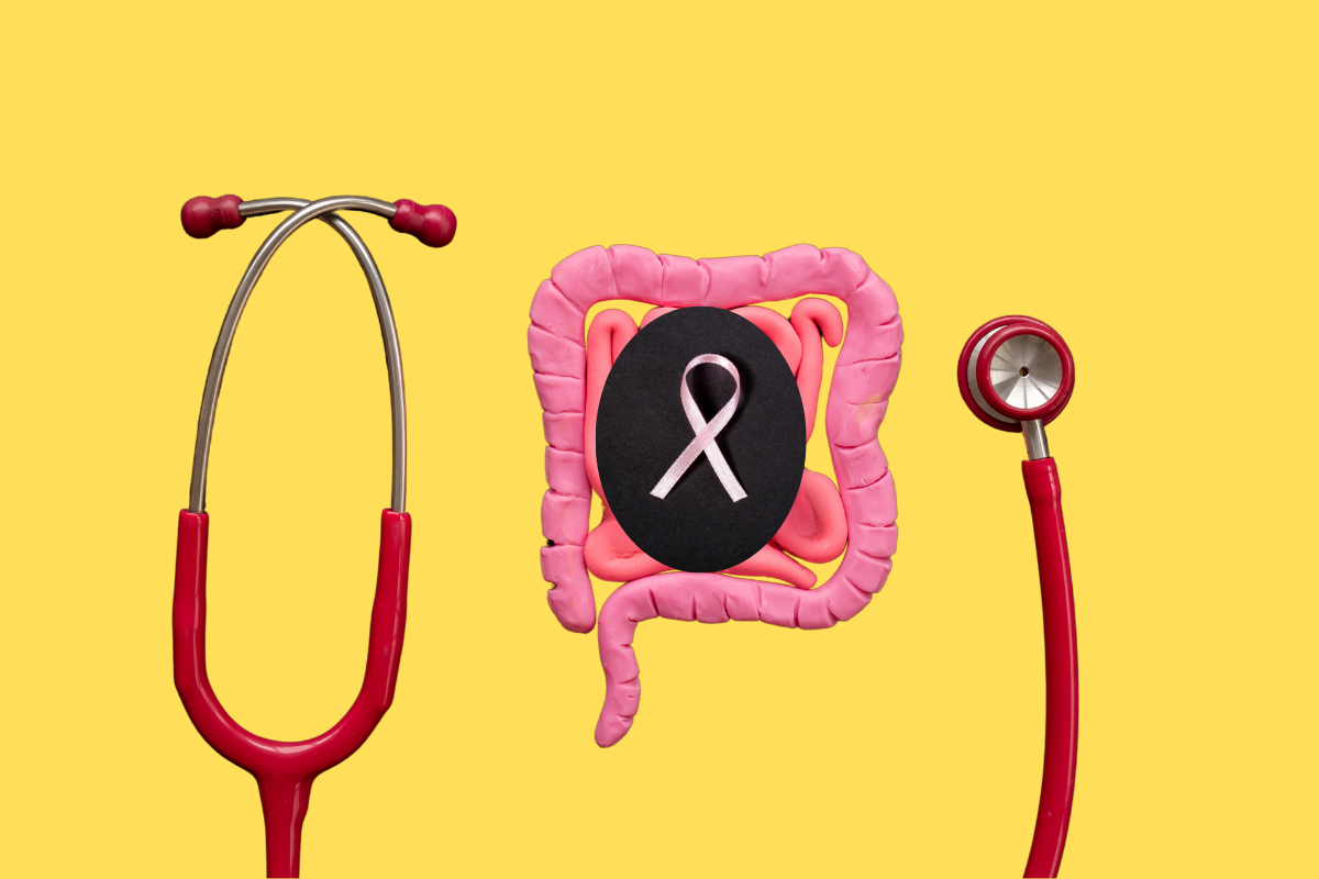 Illustration d’un intestin en pâte à modeler avec un ruban rose symbolisant le cancer du sein, entouré d’un stéthoscope rouge, sur un fond jaune.