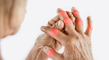 Joint pain: some basic concepts
