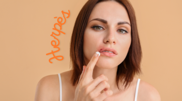 Tratar el herpes labial de forma natural: remedios y tratamientos eficaces