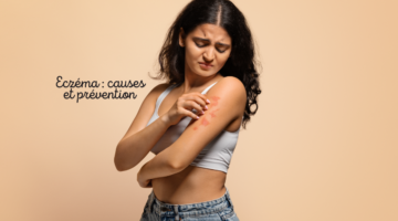 Causes of eczema: how to recognise and avoid them
