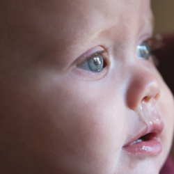 Gros plan sur le visage d’un bébé enrhumé avec un écoulement nasal, illustrant les symptômes du rhume chez le nourrisson