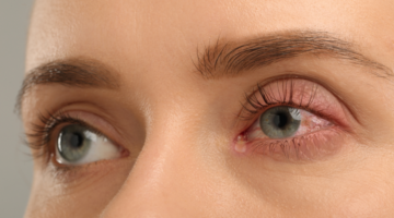 Maladie de l'œil : Reconnaître les Symptômes pour Mieux Consulter