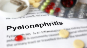 Causes de la pyélonéphrite : De la cystite à l'infection du rein