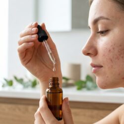 Jeune femme à la peau authentique tenant un flacon compte-gouttes en verre ambré pour appliquer un traitement naturel aux huiles essentielles contre l'acné.